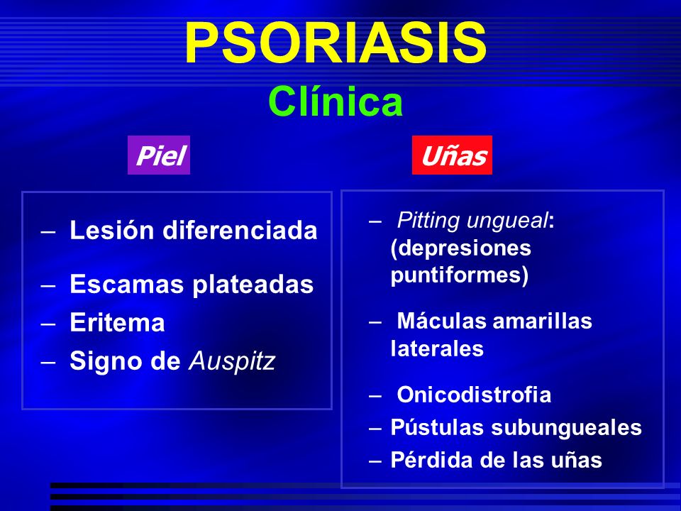 Que pinchazos para la psoriasis